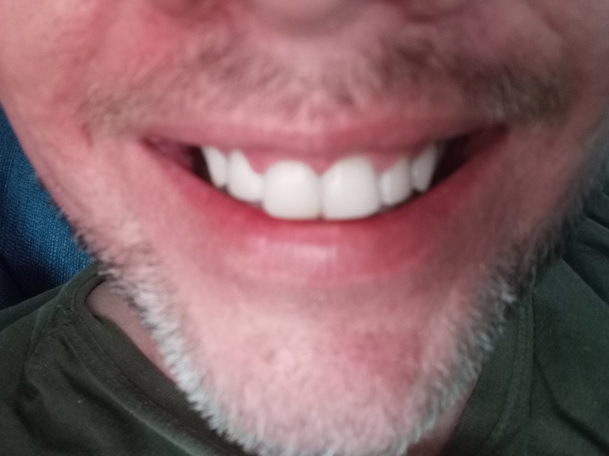 Dent Medica Bodrum - Dr. Kübra Çakır - Dent Medica Bodrum - Dr. Kübra Çakır