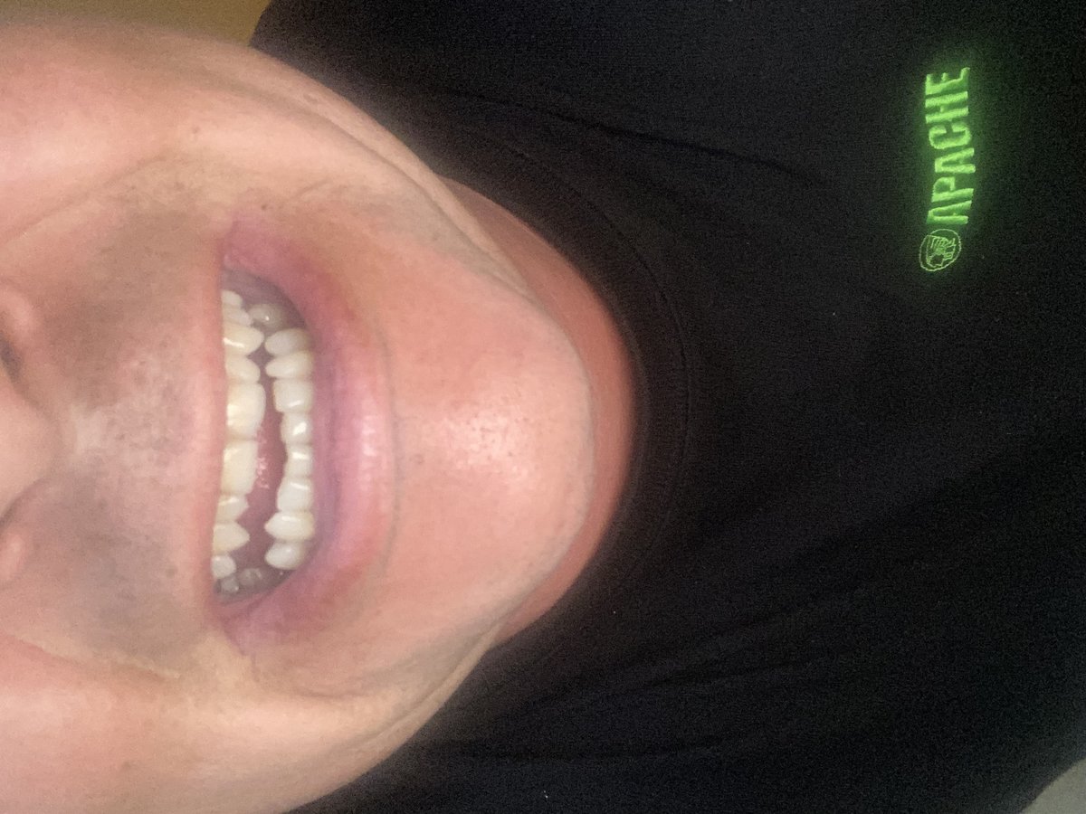 Dent Medica Bodrum - Dr. Kübra Çakır - Dent Medica Bodrum - Dr. Kübra Çakır