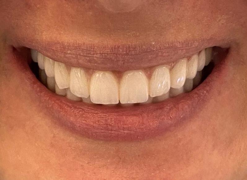 Dent Medica Bodrum - Dr. Kübra Çakır - Dent Medica Bodrum - Dr. Kübra Çakır