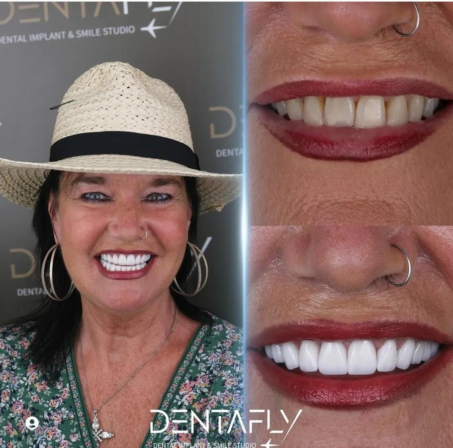 Dentafly Dental Implant and Smile Studio - Dentafly Dental Implant and Smile Studio