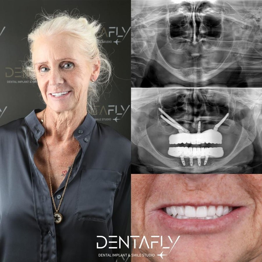 Dentafly Dental Implant and Smile Studio - Dentafly Dental Implant and Smile Studio