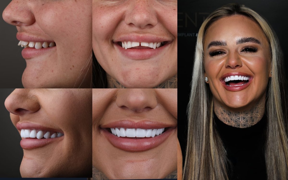 Dentafly Dental Implant and Smile Studio - Dentafly Dental Implant and Smile Studio