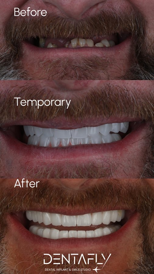 Dentafly Dental Implant and Smile Studio - Dentafly Dental Implant and Smile Studio