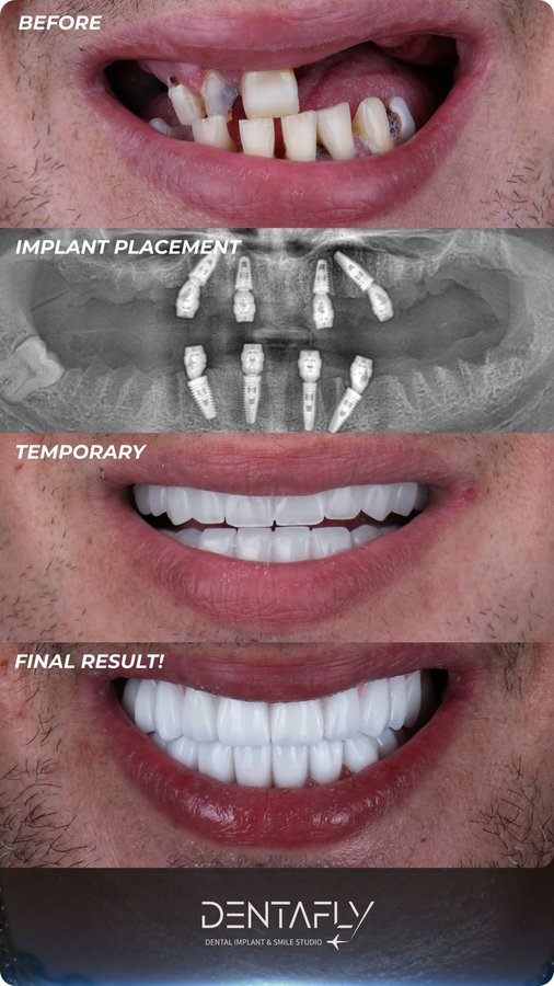 Dentafly Dental Implant and Smile Studio - Dentafly Dental Implant and Smile Studio