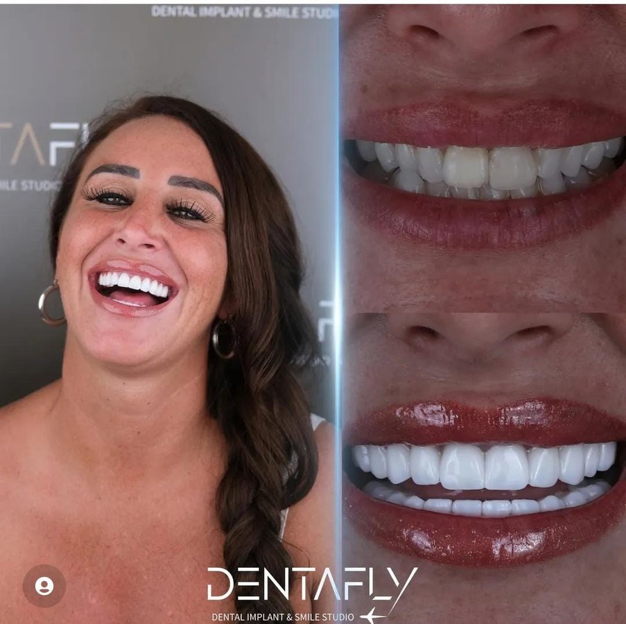 Dentafly Dental Implant and Smile Studio - Dentafly Dental Implant and Smile Studio