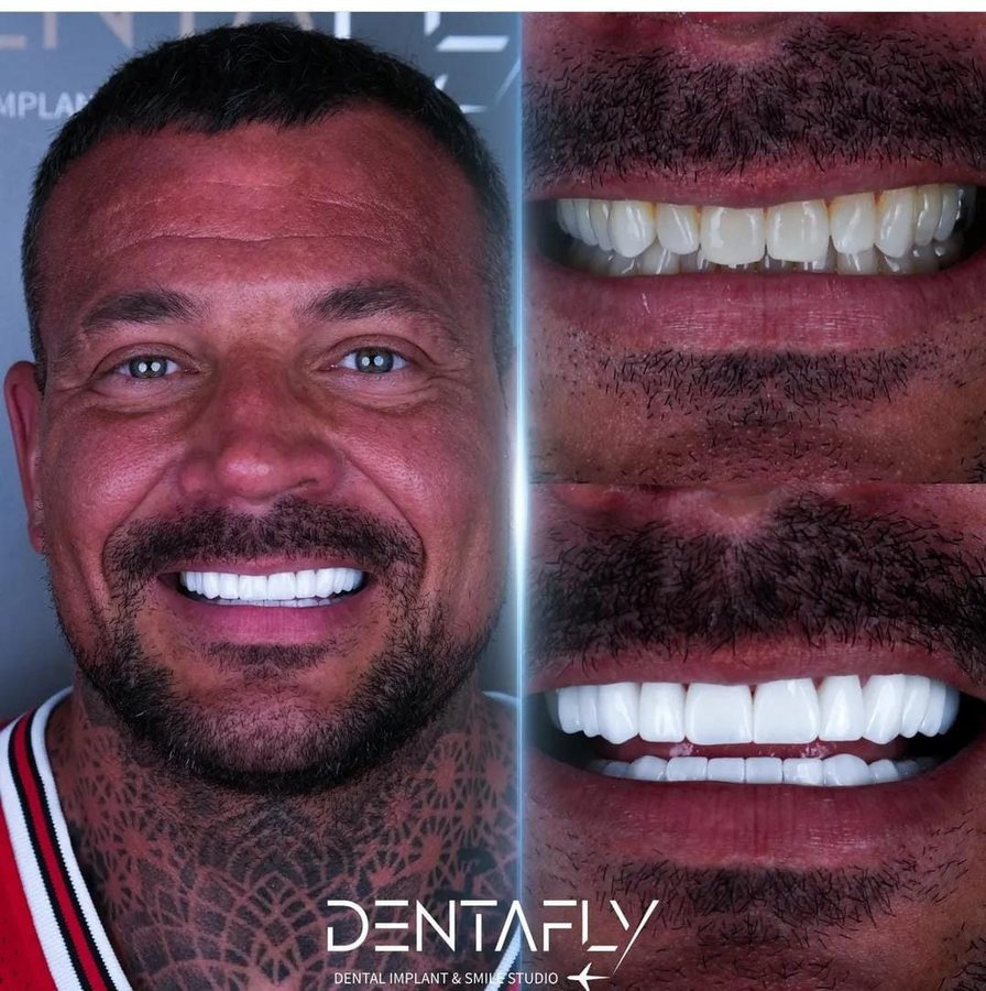 Dentafly Dental Implant and Smile Studio - Dentafly Dental Implant and Smile Studio