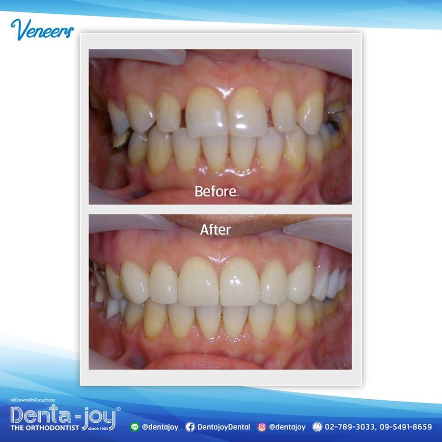 Denta-Joy - Thong lo Branch - Denta-Joy - Thong lo Branch