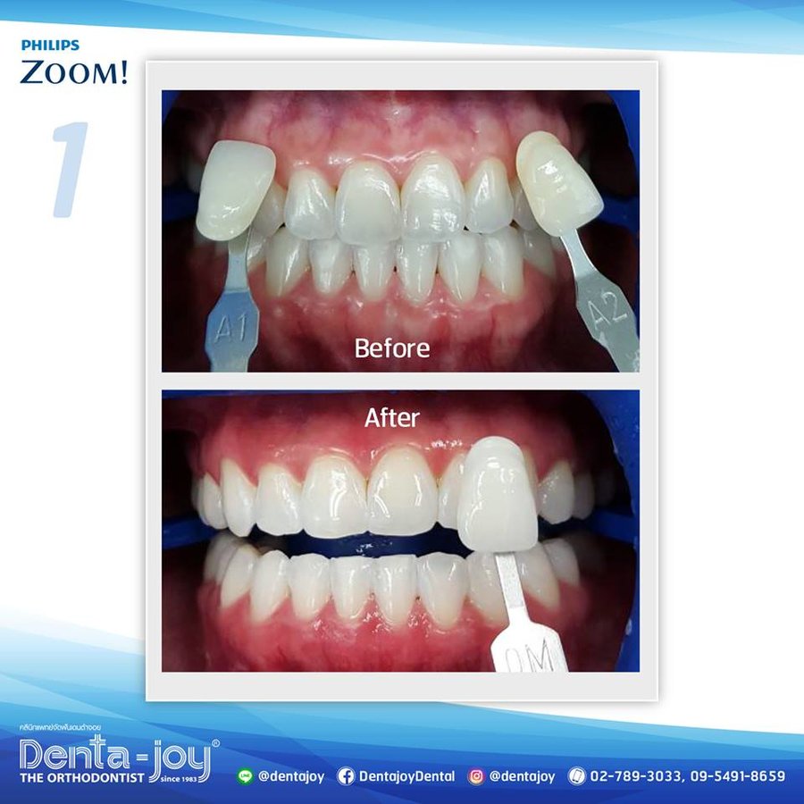 Denta-Joy - Thong lo Branch - Denta-Joy - Thong lo Branch