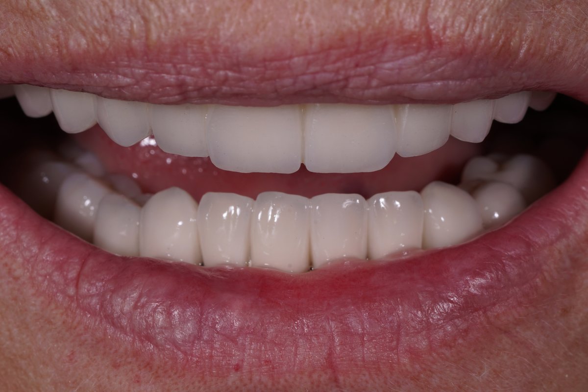 Dental Aesthetics Athens - Dental Aesthetics Athens