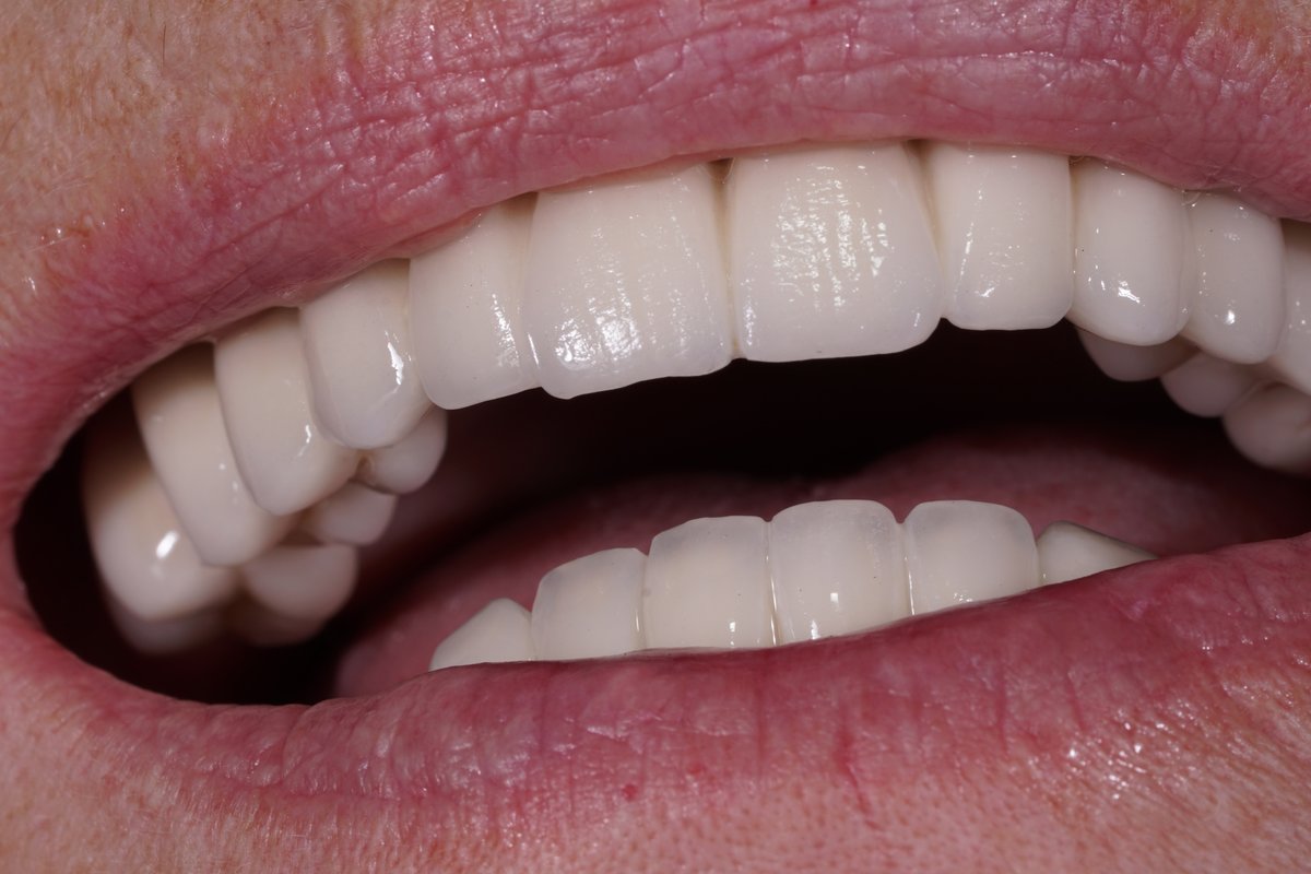 Dental Aesthetics Athens - Dental Aesthetics Athens