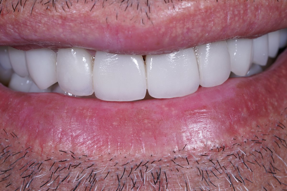 Dental Aesthetics Athens - Dental Aesthetics Athens