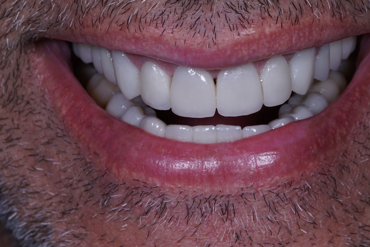 Dental Aesthetics Athens - Dental Aesthetics Athens