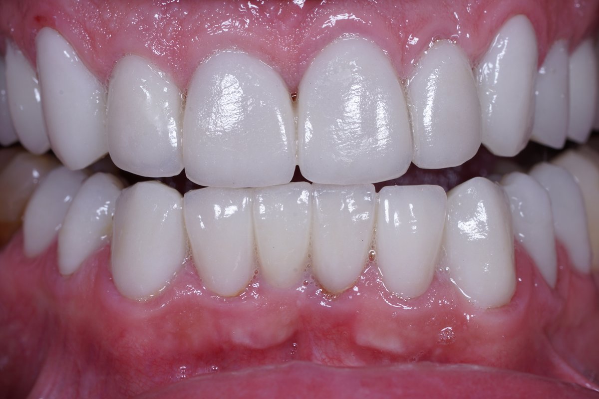 Dental Aesthetics Athens - Dental Aesthetics Athens