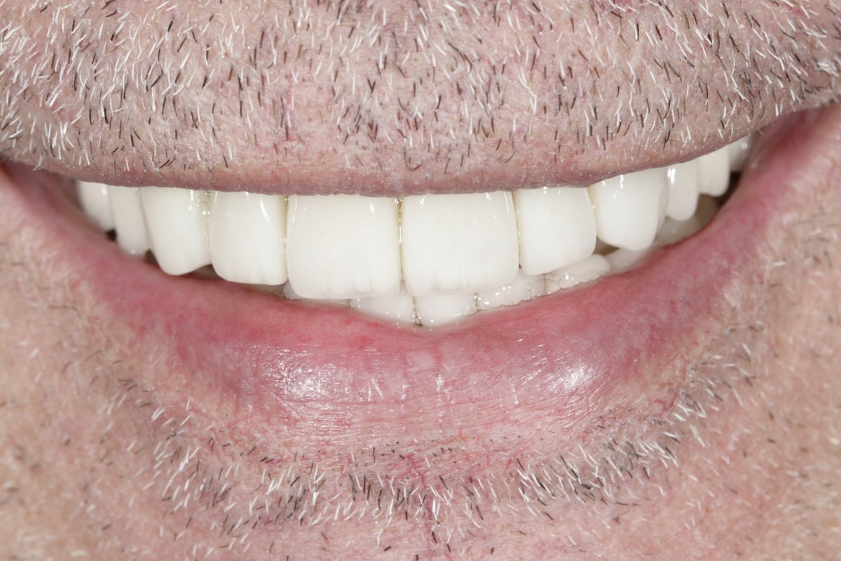 Dental Aesthetics Athens - Dental Aesthetics Athens