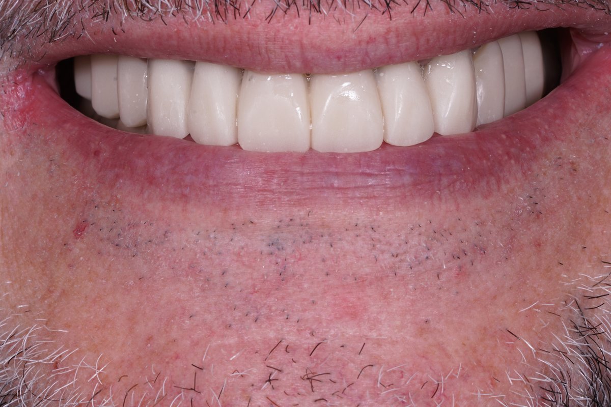 Dental Aesthetics Athens - Dental Aesthetics Athens