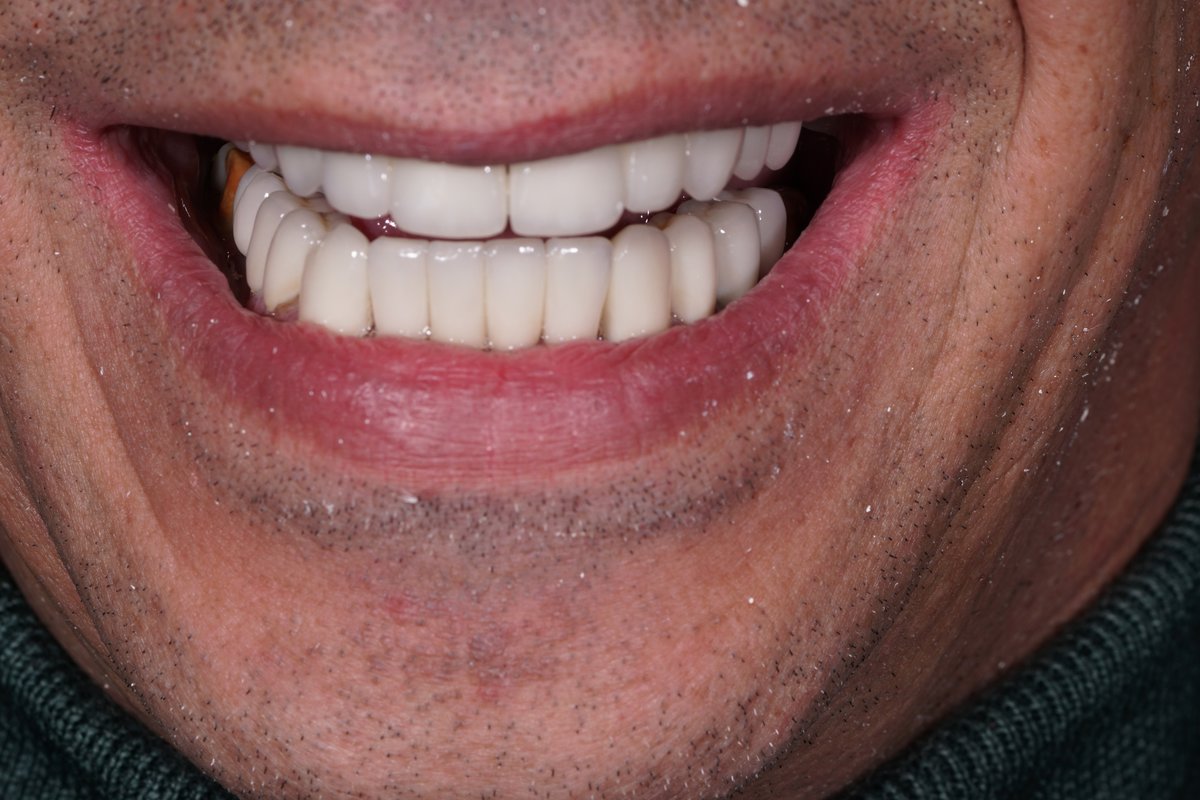 Dental Aesthetics Athens - Dental Aesthetics Athens