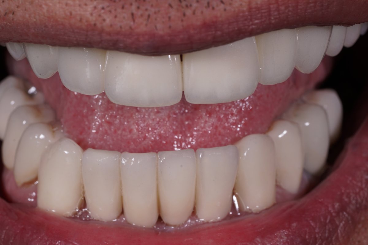 Dental Aesthetics Athens - Dental Aesthetics Athens