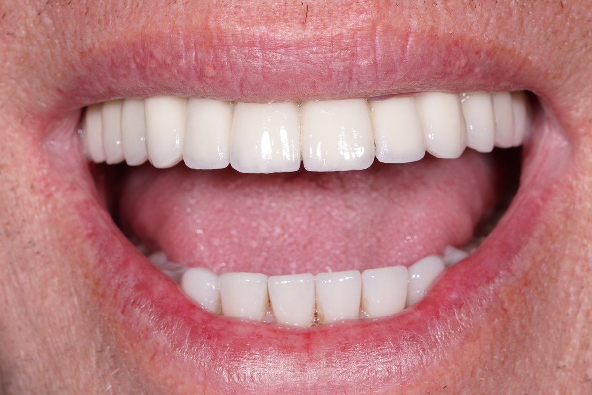 Dental Aesthetics Athens - Dental Aesthetics Athens