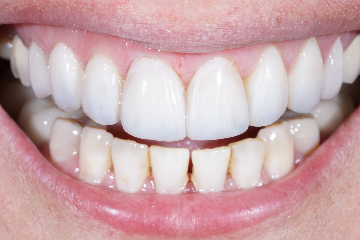 Dental Aesthetics Athens - Dental Aesthetics Athens