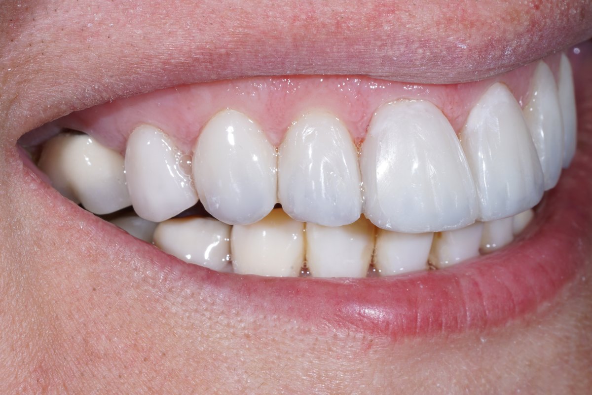 Dental Aesthetics Athens - Dental Aesthetics Athens