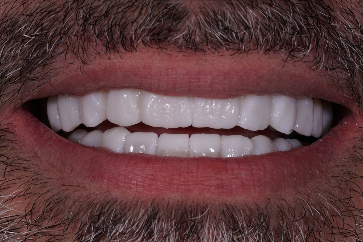 Dental Aesthetics Athens - Dental Aesthetics Athens