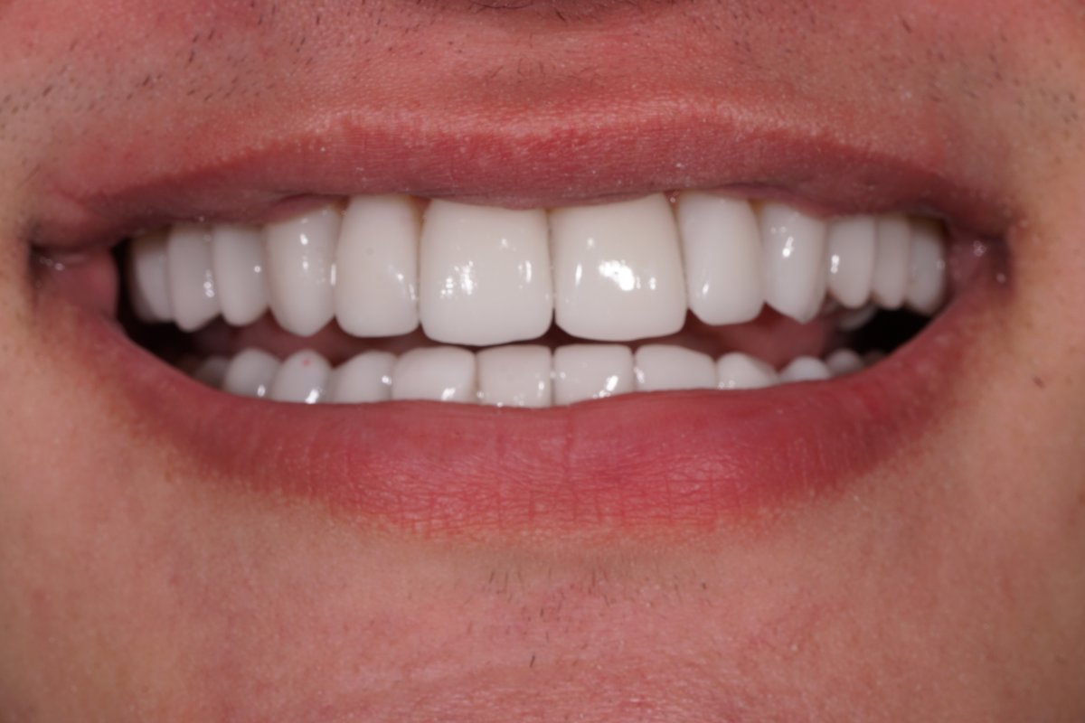 Dental Aesthetics Athens - Dental Aesthetics Athens