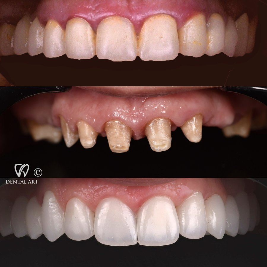 Dental Art Tirana - Dental Art Tirana