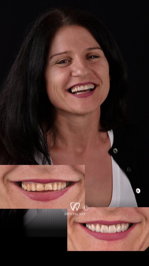 Dental Art Tirana - Dental Art Tirana