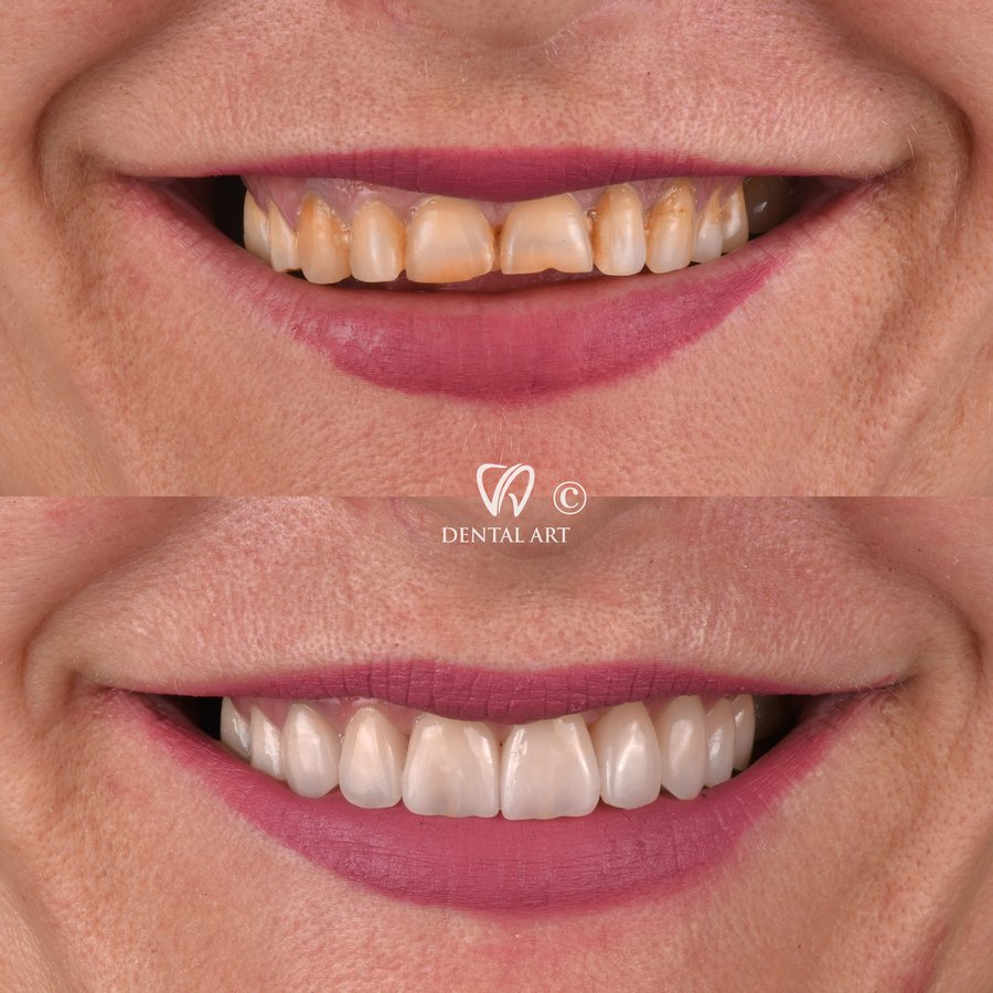 Dental Art Tirana - Dental Art Tirana