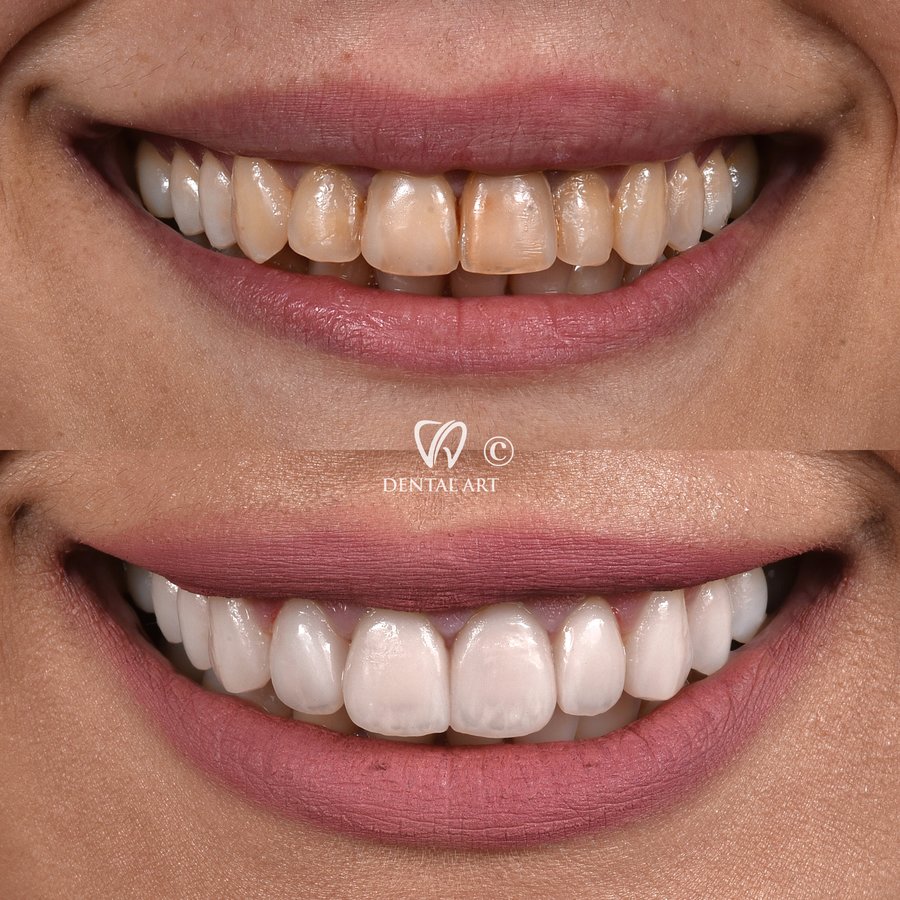 Dental Art Tirana - Dental Art Tirana