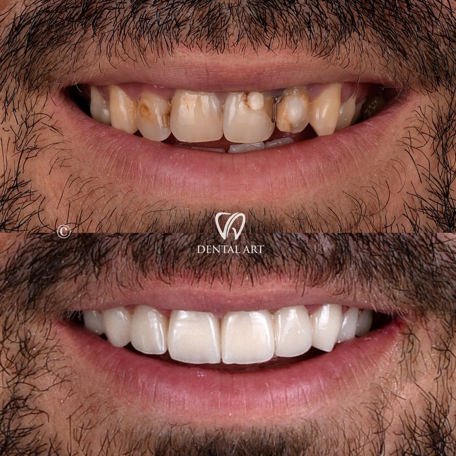 Dental Art Tirana - Dental Art Tirana