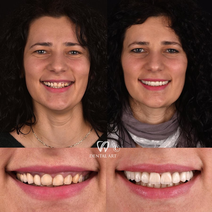 Dental Art Tirana - Dental Art Tirana