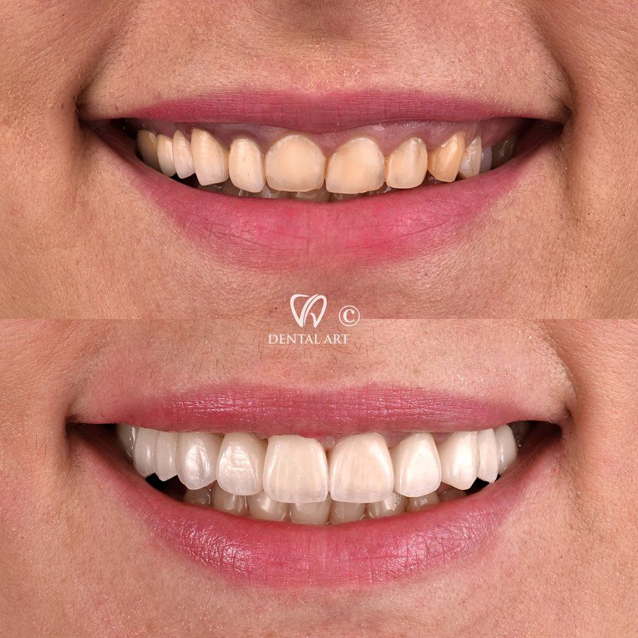 Dental Art Tirana - Dental Art Tirana