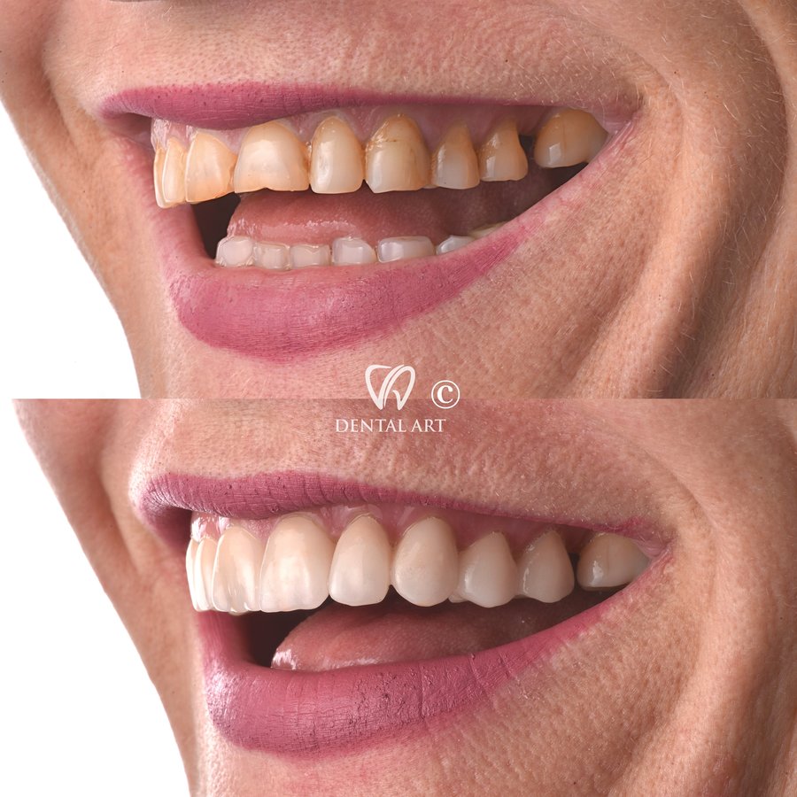 Dental Art Tirana - Dental Art Tirana