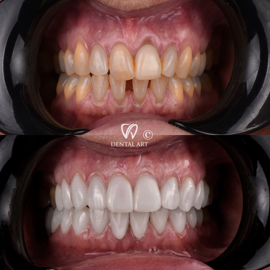 Dental Art Tirana - Dental Art Tirana