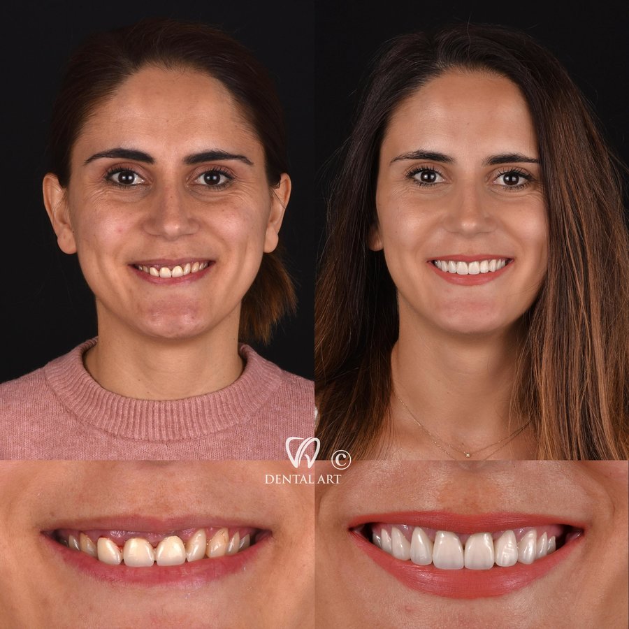 Dental Art Tirana - Dental Art Tirana