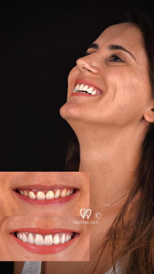 Dental Art Tirana - Dental Art Tirana