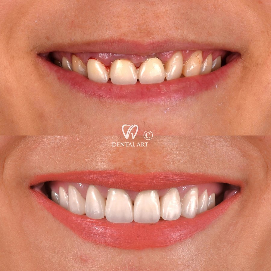 Dental Art Tirana - Dental Art Tirana