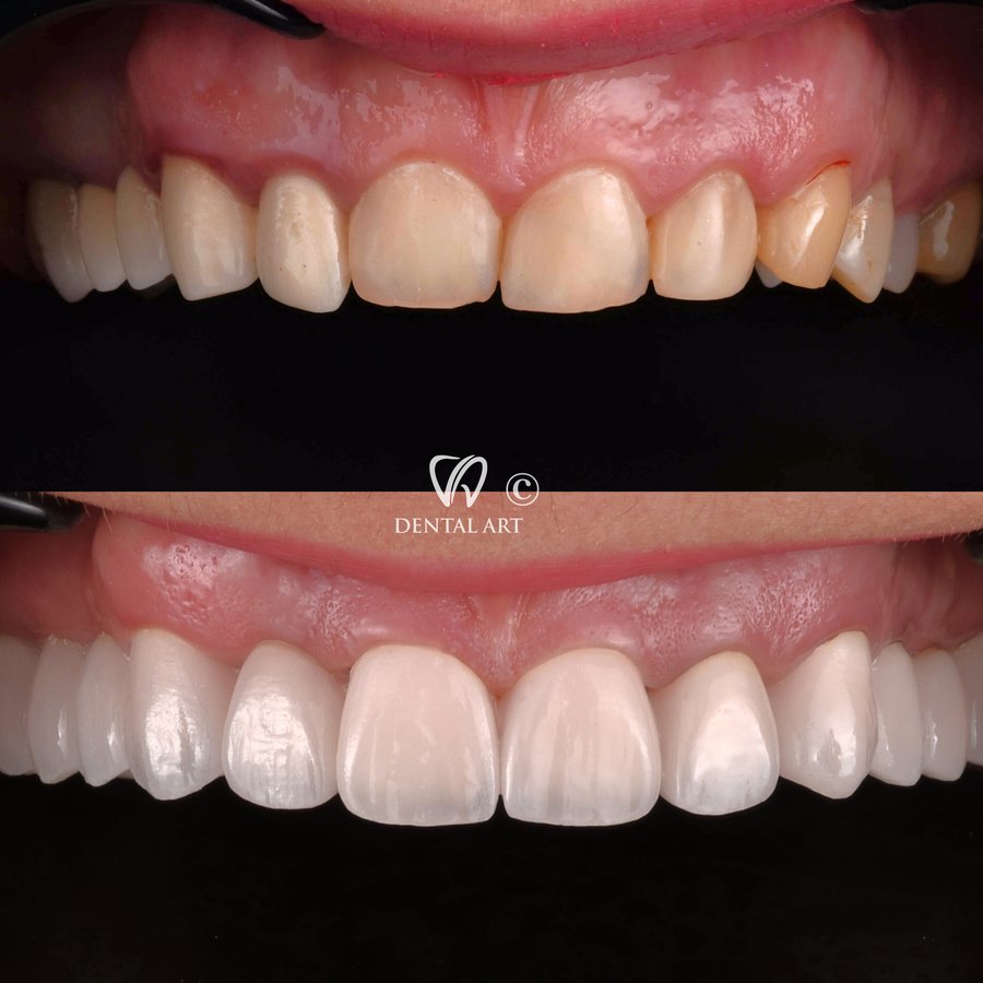 Dental Art Tirana - Dental Art Tirana