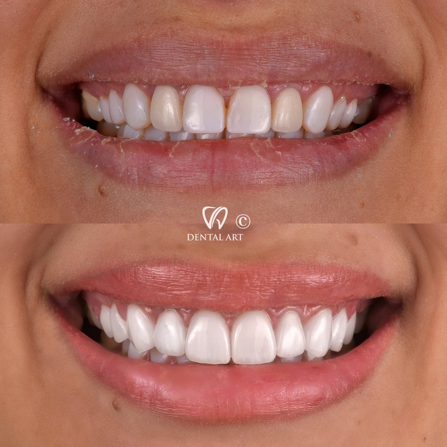 Dental Art Tirana - Dental Art Tirana