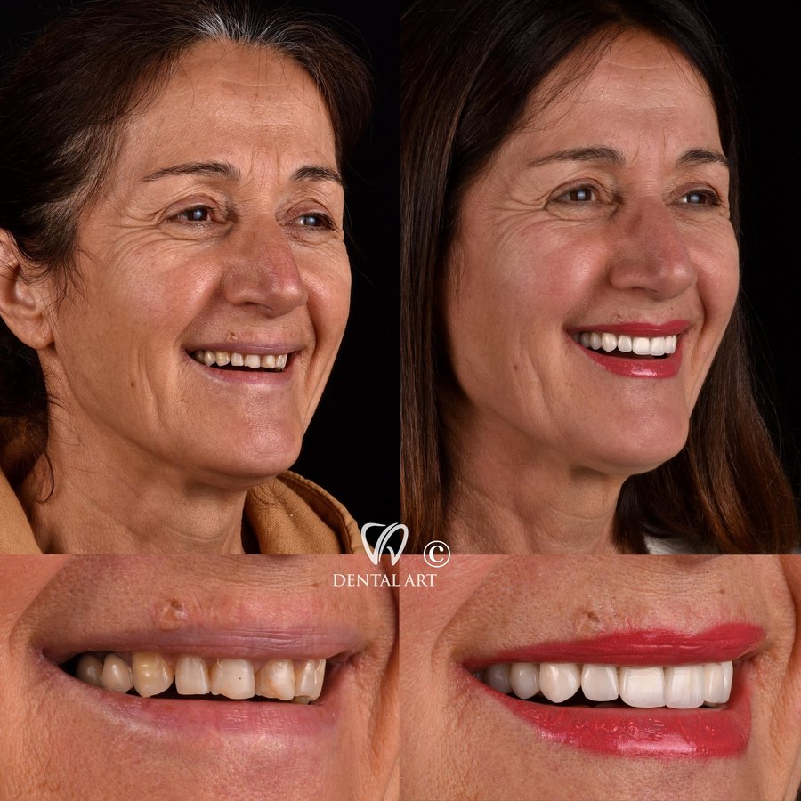 Dental Art Tirana - Dental Art Tirana