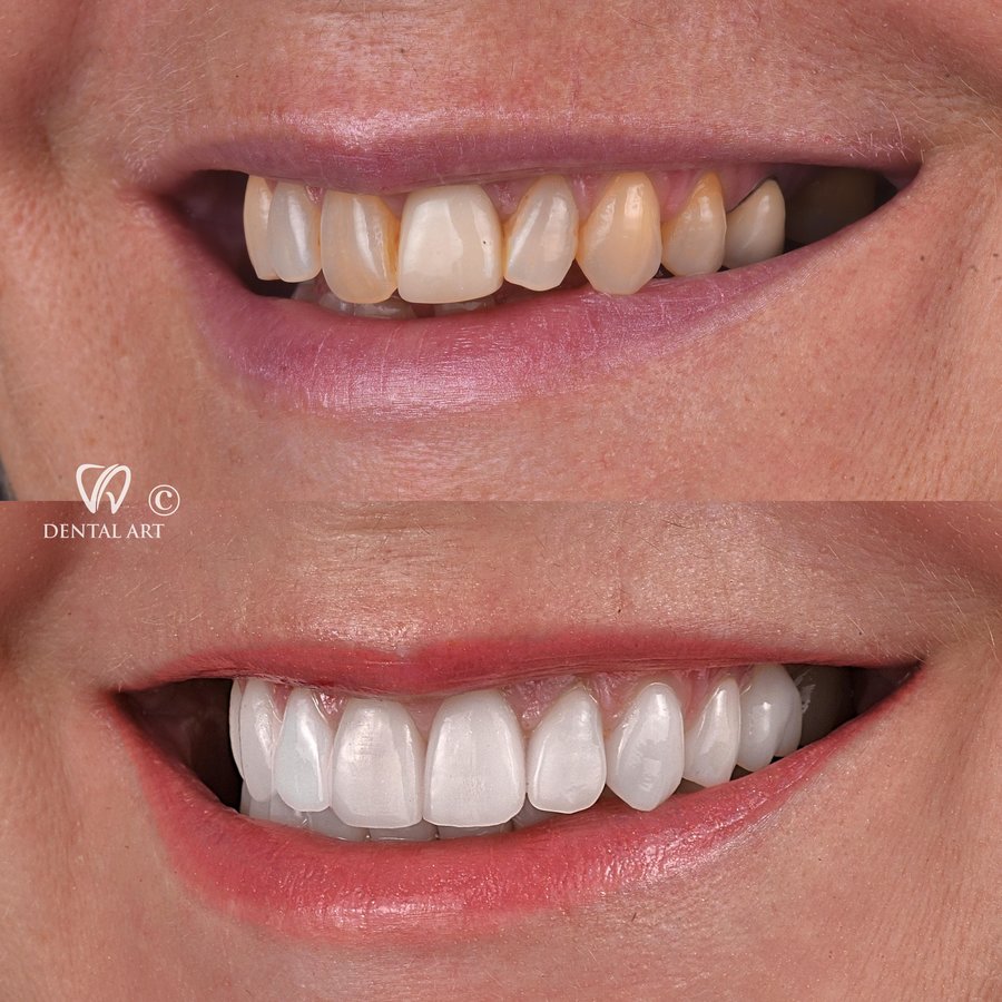 Dental Art Tirana - Dental Art Tirana