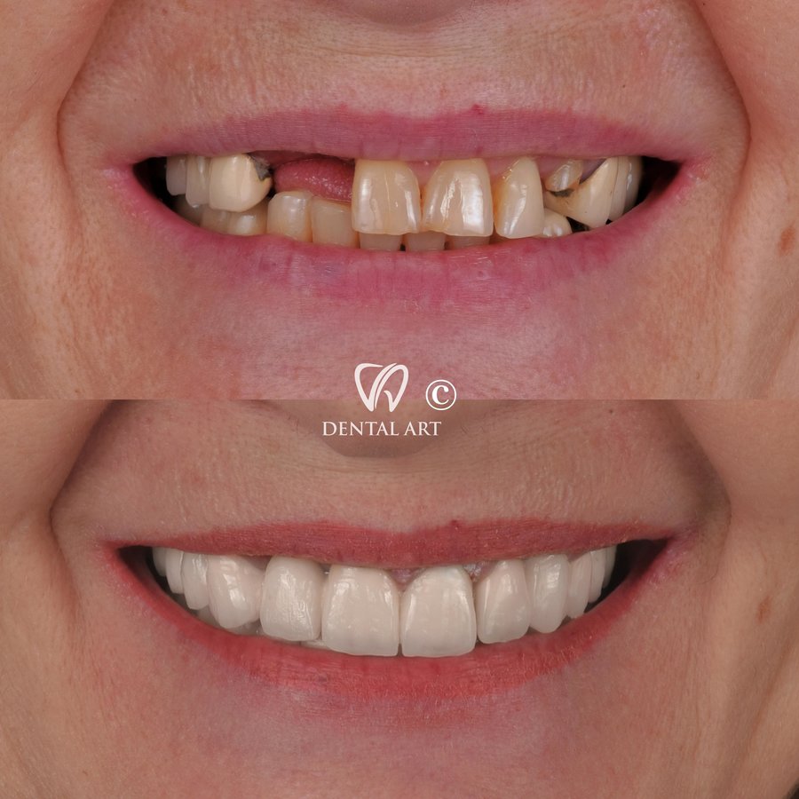 Dental Art Tirana - Dental Art Tirana