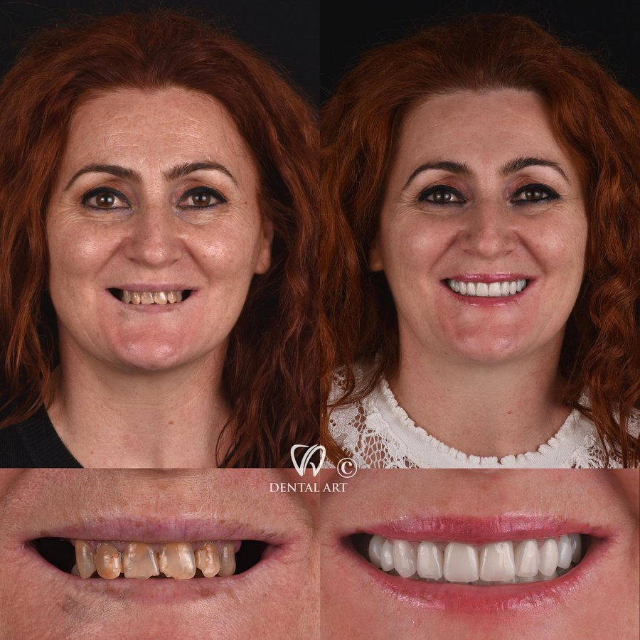 Dental Art Tirana - Dental Art Tirana