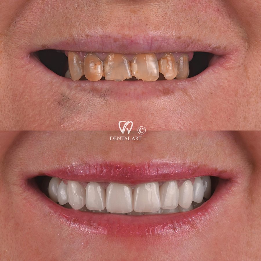 Dental Art Tirana - Dental Art Tirana