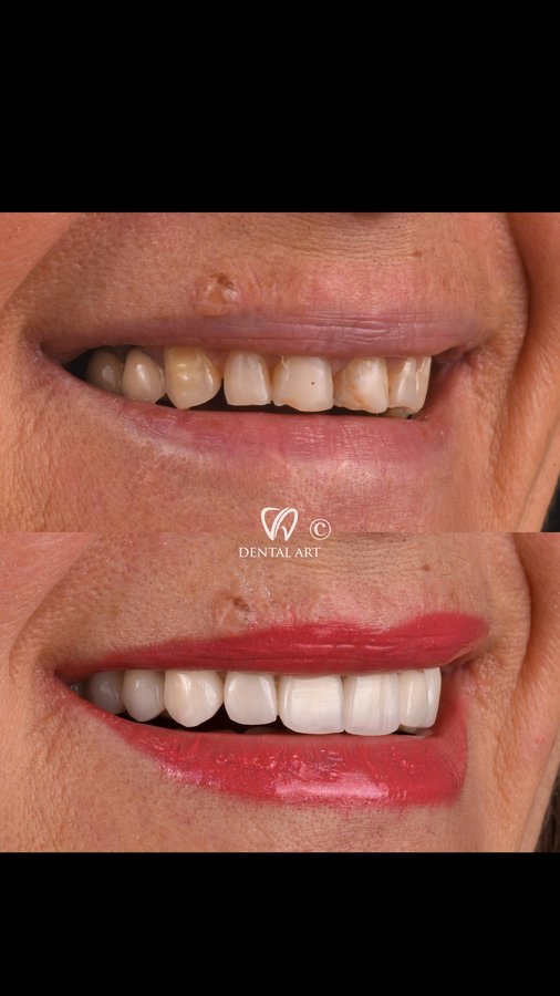 Dental Art Tirana - Dental Art Tirana