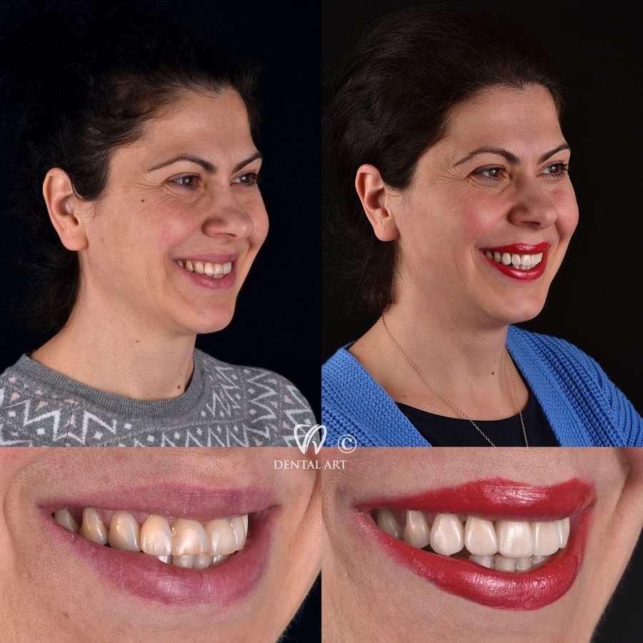 Dental Art Tirana - Dental Art Tirana
