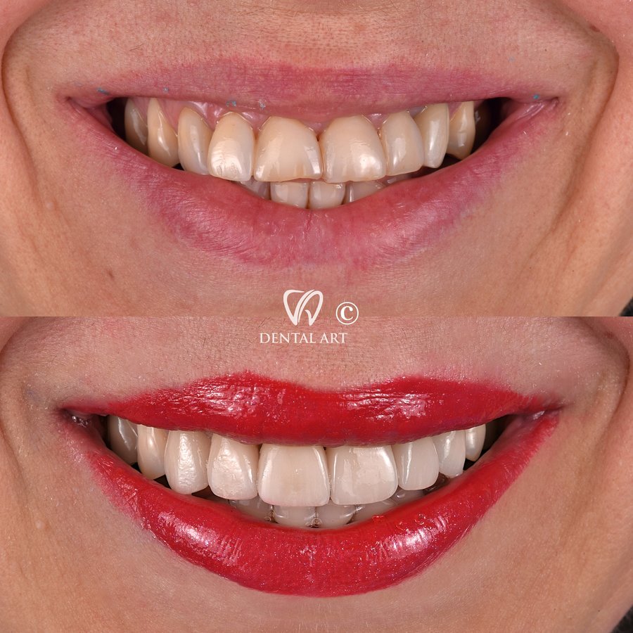 Dental Art Tirana - Dental Art Tirana