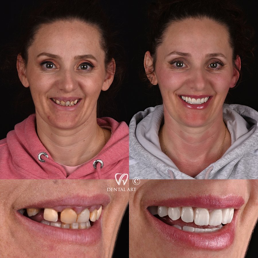 Dental Art Tirana - Dental Art Tirana