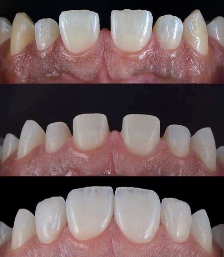 Dental Beauty - Dental Beauty